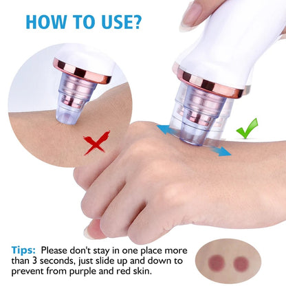 5 in 1 Blackhead remover | Derma Suction  | Rechargeable