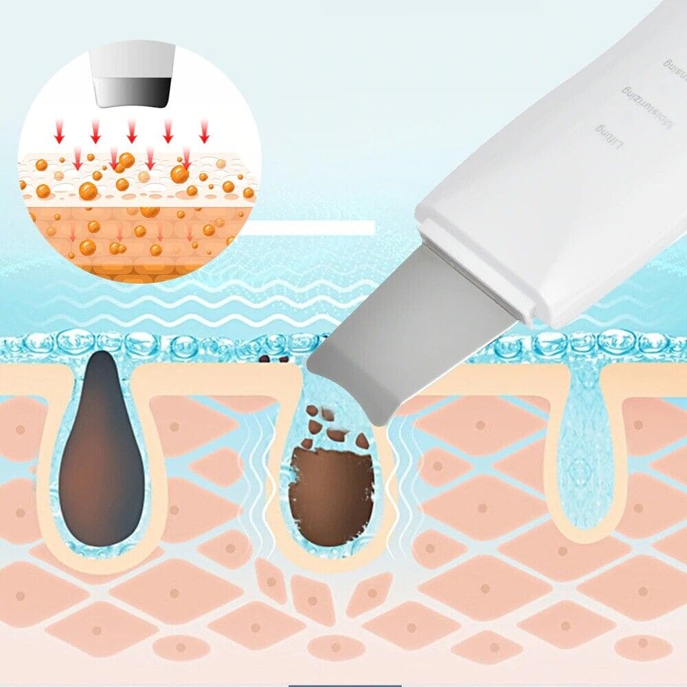 Skin Scrubber Facial Skin Scrubber, Ultrasonic Skin Scrubber Spatula, Electric Blackhead Remover, Facial Cleaner Spatula, 3 Modes Facial Lifting Peeling Tool, Rechargeable Skin Massage Scrubber